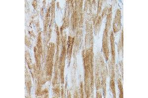 Immunohistochemistry (IHC) image for anti-ATPase, Ca++ Transporting, Cardiac Muscle, Slow Twitch 2 (ATP2A2) (AA 111-253) antibody (ABIN3021430)