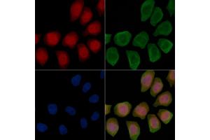 Phospho-IP3 Receptor (Ser1598) Antibody staining Hela cells(45 min of heat-shock treatment) by IF/ICC. (IP3 Receptor 抗体  (pSer1598))