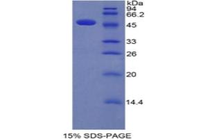 SDS-PAGE analysis of Human Interferon alpha Protein. (IFNA 蛋白)