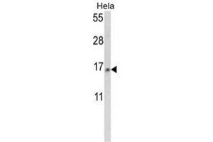 Western blot analysis of SNRPD2 Antibody (N-term) in Hela cell line lysates (35ug/lane). (SNRPD2 抗体  (N-Term))