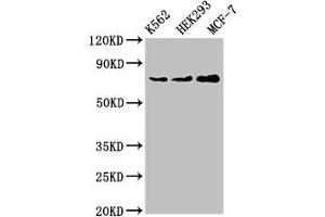 Western Blot Positive WB detected in: K562 whole cell lysate, HEK293 whole cell lysate, MCF-7 whole cell lysate All lanes: RALBP1 antibody at 4 μg/mL Secondary Goat polyclonal to rabbit IgG at 1/50000 dilution Predicted band size: 77 kDa Observed band size: 77 kDa (RALBP1 抗体  (AA 6-105))