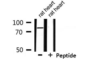 Western blot analysis of extracts from rat heart , using ZFYVE20 Antibody. (Rabenosyn 5 抗体  (Internal Region))