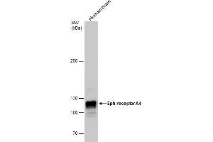WB Image Eph receptor A4 antibody detects Eph receptor A4 protein by western blot analysis. (EPH Receptor A4 抗体)