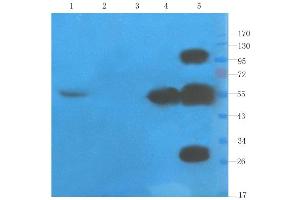Western Blot using anti-TNFalpha antibody  Rat liver (lane 1), rat spinal cord (lane 2), mouse testis (lane 3), rat colon (lane 4) and human thyroid tumour (lane 5) samples were resolved on a 10% SDS PAGE gel and blots probed with  at 1 µg/ml before being detected by a secondary antibody. (Recombinant TNF alpha (Humicade Biosimilar) 抗体)