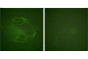 Immunofluorescence analysis of HeLa cells, using HRS (Ab-334) Antibody. (HRS (HRS) (AA 301-350) 抗体)