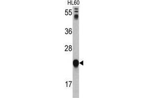 Western blot analysis of GLO1 antibody (N-term) in HL60 cell line lysates (35 µg/lane). (GLO1 抗体  (N-Term))
