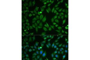 Immunofluorescence analysis of U2OS cells using SCG2 Polyclonal Antibody (SCG2 抗体)