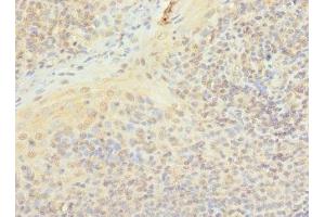 Immunohistochemistry of paraffin-embedded human tonsil tissue using ABIN7163185 at dilution of 1:100 (PIP5K1A 抗体  (AA 293-562))