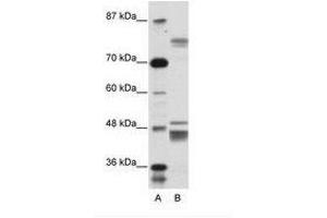 Image no. 1 for anti-Zinc Finger Protein 607 (ZNF607) (AA 312-361) antibody (ABIN6736155) (ZNF607 抗体  (AA 312-361))