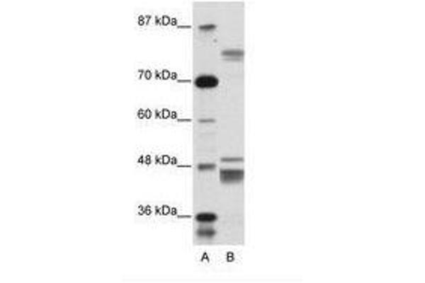ZNF607 anticorps  (AA 312-361)