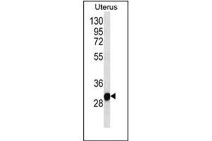 Western blot analysis of RNF148 Antibody (C-term) in Human normal Uterus cell line lysates (35ug/lane). (RNF148 抗体  (C-Term))