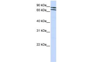 WB Suggested Anti-ZNF572 Antibody Titration:  0. (ZNF572 抗体  (N-Term))