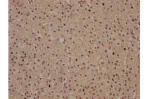 IHC image of ABIN7140118 diluted at 1:100 and staining in paraffin-embedded human adrenal gland tissue performed on a Leica BondTM system. (RHBDD3 抗体  (AA 304-323))