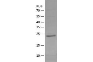 Western Blotting (WB) image for Charged Multivesicular Body Protein 2B (CHMP2B) (AA 1-213) protein (His tag) (ABIN7122253) (CHMP2B Protein (AA 1-213) (His tag))