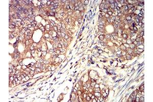 Immunohistochemistry (IHC) image for anti-ARP3 Actin-Related Protein 3 (ACTR3) (AA 287-418) antibody (ABIN5611286)