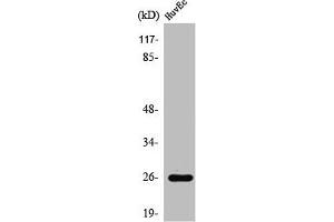Western Blot analysis of COLO205 cells using Rab L2A Polyclonal Antibody (RABL2A 抗体  (C-Term))