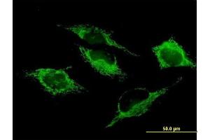 Immunofluorescence of purified MaxPab antibody to SHMT2 on HeLa cell.