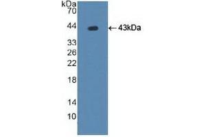Detection of Recombinant ATP7b, Human using Polyclonal Antibody to ATPase, Cu++ Transporting Beta Polypeptide (ATP7b) (ATP7B 抗体  (AA 59-426))