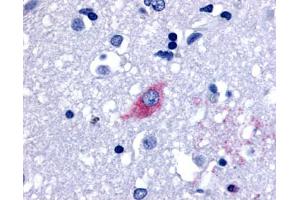 Anti-LGR4 antibody IHC of human brain, neurons and glia. (LGR4 抗体  (Cytoplasmic Domain))