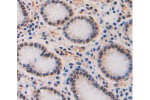 Used in DAB staining on fromalin fixed paraffin- embedded Kidney tissue