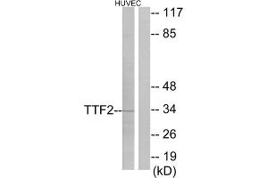 Western blot analysis of extracts from HUVEC cells, using TTF2 antibody. (TTF2 抗体  (N-Term))