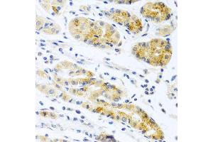 Immunohistochemistry of paraffin-embedded human stomach using PROK2 antibody at dilution of 1:100 (40x lens). (PROK2 抗体)