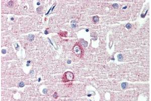 anti-Discs, Large (Drosophila) Homolog-Associated Protein 1 (DLGAP1) (AA 391-405) antibody