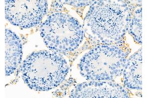 ABIN6265755 and ABIN6273335 at 1/100 staining Mouse testis tissue by IHC-P.