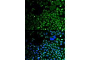 Immunofluorescence analysis of A549 cells using HDAC2 antibody (ABIN5971110). (HDAC2 抗体)