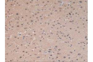 IHC-P analysis of Human Liver Tissue, with DAB staining. (ARG 抗体  (AA 1-322))