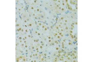 Immunohistochemistry of paraffin-embedded rat kidney using RCC1 antibody (ABIN5973761) at dilution of 1/100 (40x lens). (RCC1 抗体)