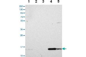 Western blot analysis of Lane 1: RT-4 Lane 2: U-251 MG Lane 3: Human Plasma Lane 4: Liver Lane 5: Tonsil with DUSP23 polyclonal antibody . (DUSP23 抗体)
