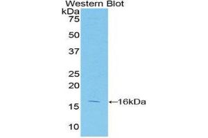 Western Blotting (WB) image for anti-Caspase 2, Apoptosis-Related Cysteine Peptidase (CASP2) (AA 334-452) antibody (ABIN1077908) (Caspase 2 抗体  (AA 334-452))