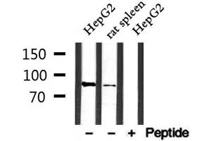 Western blot analysis of extracts from rat spleen and HepG2, using SFRS18 Antibody. (SFRS18 抗体  (Internal Region))