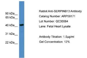 WB Suggested Anti-SERPINB13  Antibody Titration: 0. (SERPINB13 抗体  (Middle Region))