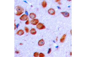 Immunohistochemical analysis of LT beta staining in human brain formalin fixed paraffin embedded tissue section. (LTB 抗体  (C-Term))