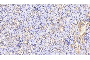 Immunohistochemistry (IHC) image for anti-beta-Site APP-Cleaving Enzyme 2 (BACE2) (AA 156-407) antibody (ABIN7438664)