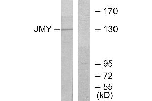 Western blot analysis of extracts from COLO cells, using JMY antibody. (JMY 抗体  (Internal Region))