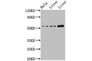 Western Blot Positive WB detected in: Hela whole cell lysate, Rat liver tissue, Mouse liver tissue All lanes: IFIT1 antibody at 4 μg/mL Secondary Goat polyclonal to rabbit IgG at 1/50000 dilution Predicted band size: 56, 52 kDa Observed band size: 56 kDa (IFIT1 抗体  (AA 1-181))