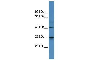 CA2 antibody used at 0. (CA2 抗体  (C-Term))