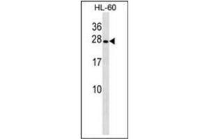 Western blot analysis of PGRMC2 Antibody (C-term) in HL-60 cell line lysates (35ug/lane). (PGRMC2 抗体  (C-Term))