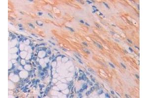 Detection of CA7 in Mouse Colon Tissue using Polyclonal Antibody to Carbonic Anhydrase VII (CA7) (CA7 抗体  (AA 58-217))