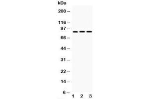 Western blot testing of CD18 antibody and Lane 1:  HeLa;  2: Jurkat;  3: HT1080;  Predicted/Observed size: 85~95KD depending on glycosylation level (Integrin beta 2 抗体  (N-Term))