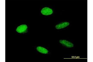 Immunofluorescence of purified MaxPab antibody to HMGA1 on HeLa cell. (HMGA1 抗体  (AA 1-96))