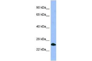 WB Suggested Anti-SMN1 Antibody Titration: 1. (SMN1 抗体  (C-Term))