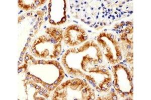 Immunohistochemical analysis of paraffin-embedded human kidney using beta-Tubulin antibody at 1:25 dilution. (TUBB1 抗体)