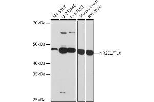 Western blot analysis of extracts of various cell lines, using NR2E1/TLX Rabbit mAb (ABIN7269014) at 1:1000 dilution.