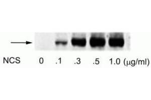 Western blot of human melanoma cells incubated with varying doses of the radiomimetic drug NCS showing specific immunolabeling of the ~74 kDa ATF2 protein phosphorylated at Ser490 and Ser498. (ATF2 抗体  (pSer490, pSer498))