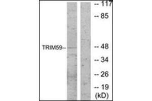 Western blot analysis of extracts from NIH-3T3 cells, using TRIM59 Antibody .