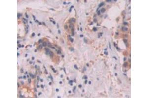 Immunohistochemistry (IHC) image for anti-Sema Domain, Immunoglobulin Domain (Ig), Short Basic Domain, Secreted, (Semaphorin) 3F (SEMA3F) (AA 604-785) antibody (ABIN1860522)